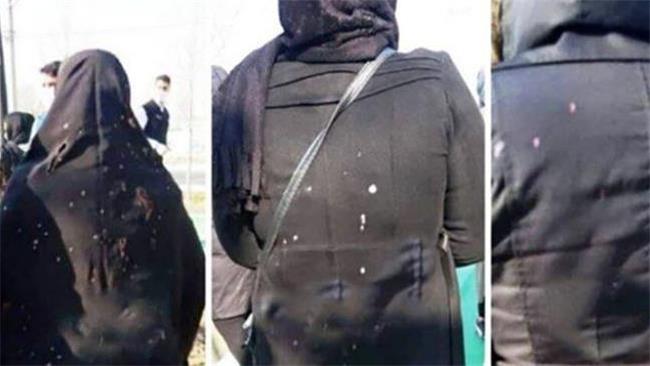 ماجرای اسید پاشی به زنان در شهریار چه بود؟