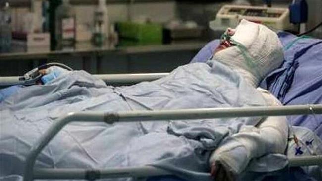 افزایش تلفات سوختگی در استان اصفهان
